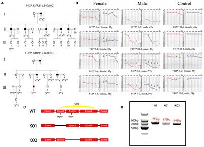 SMPX Deficiency Causes Stereocilia Degeneration and Progressive Hearing Loss in CBA/CaJ Mice